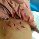 Korban Gigitan Monyet Liar di Tembilahan Bertambah Jadi 10 Orang, Tim Gabungan Sisir Permukiman Gunakan Perahu Karet
