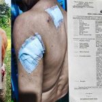 Penganiayaan Berat di Caringin Bogor: Wilson Lalengke Kecam Aksi Main Hakim Sendiri, Desak Polisi Usut Tuntas Terduga Pelaku ‘Imron’
